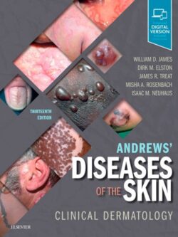 Andrews’ Diseases of the Skin: Clinical Dermatology (13th Edition)
