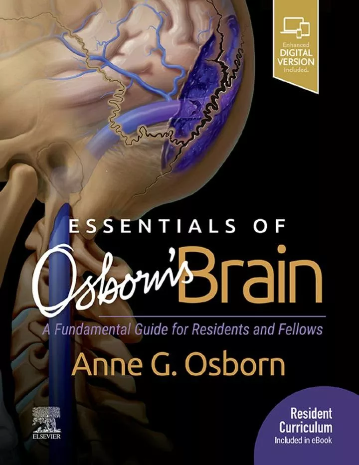 Essentials of Osborn’s Brain