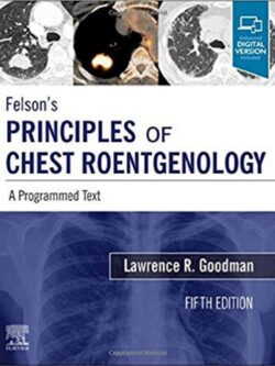 Felson’s Principles of Chest Roentgenology (5th Edition)