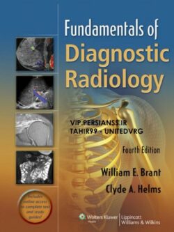 Fundamentals of Diagnostic Radiology (4th Edition) – In one volume