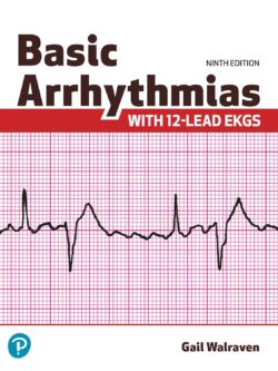 Basic Arrhythmias With 12-Lead EKGs (9th Edition)