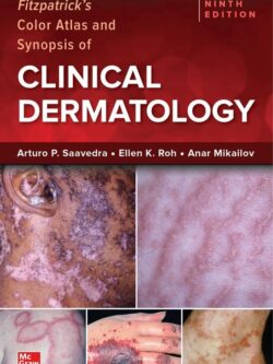 Fitzpatrick's Color Atlas and Synopsis of Clinical Dermatology (9th Edition)