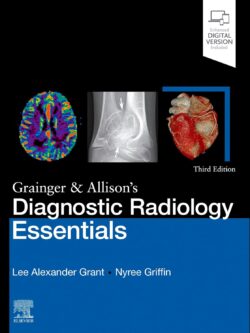 Grainger & Allison's Diagnostic Radiology Essentials (3rd Edition)