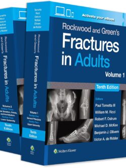 Rockwood and Green's Fractures in Adults (10th Edition) eBook without Multimedia
